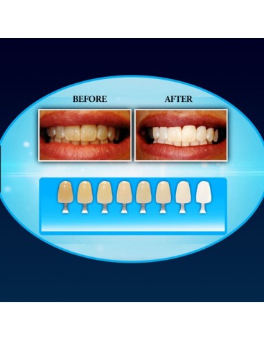 20 MINUTE DENTAL WHITE BRANQUEAMENTO DENTAL | Virtualvantagem | VRT.002.00085