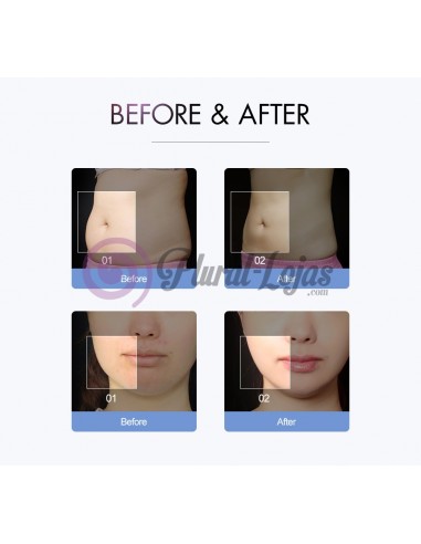 MAQUINA S SHAPE CAVITAÇÃO MULTIFUNÇÕES | Virtualvantagem | VRT.001.00027