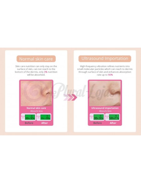 MICRODERMOABRASÃO + PEELING+ JATO DE OXIGENIO | Virtualvantagem | VRT.001.00011