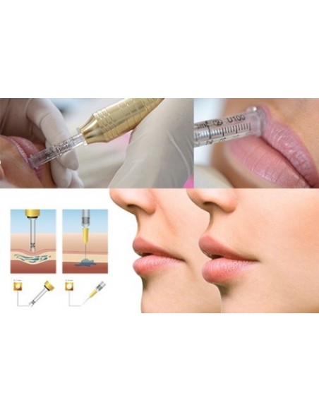 CANETA INTRADERMOTERAPIA PRESSURIZADA PORTUGAL | Virtualvantagem | VRT.002.00036