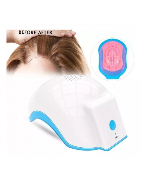 CAPACETE DE LED PARA QUEDA CABELO LH80 PRO | Virtualvantagem | VRT.001.00042