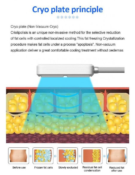 MAQUINA DE CRIOLIPOLISE DE PLACAS + EMS | Virtualvantagem | VRT.001.00070