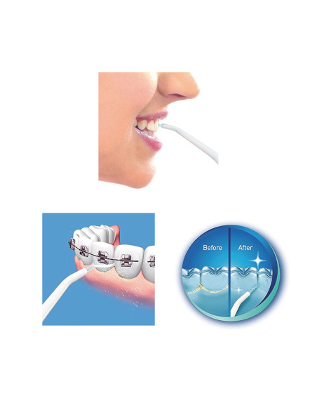 IRRIGADOR ORAL MANUAL