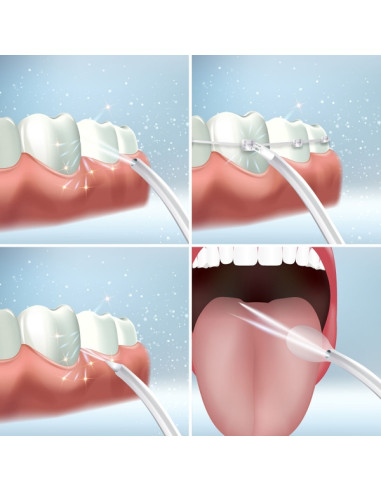 IRRIGADOR DENTAL ELETRICO RECARREGAVEL